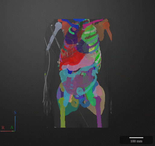 Scan Animated Gif
