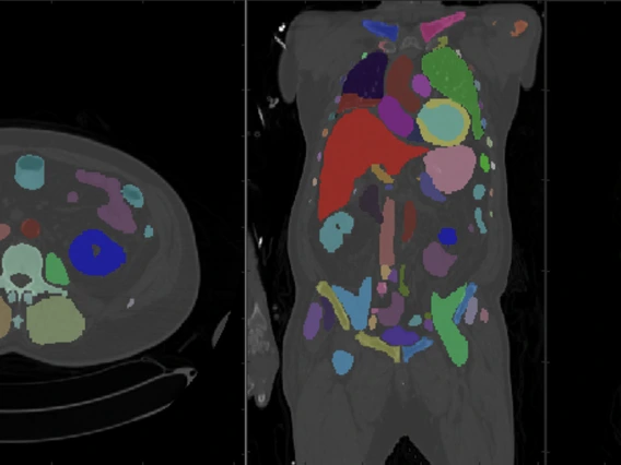 Body_Scan_Image