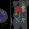 Body_Scan_Image